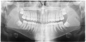 Brook Dental Associates Panoramic Xray