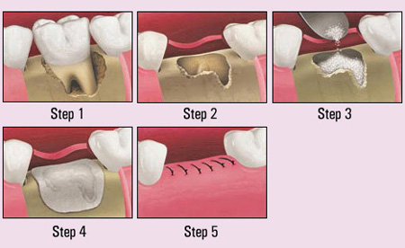 bound brook dentist